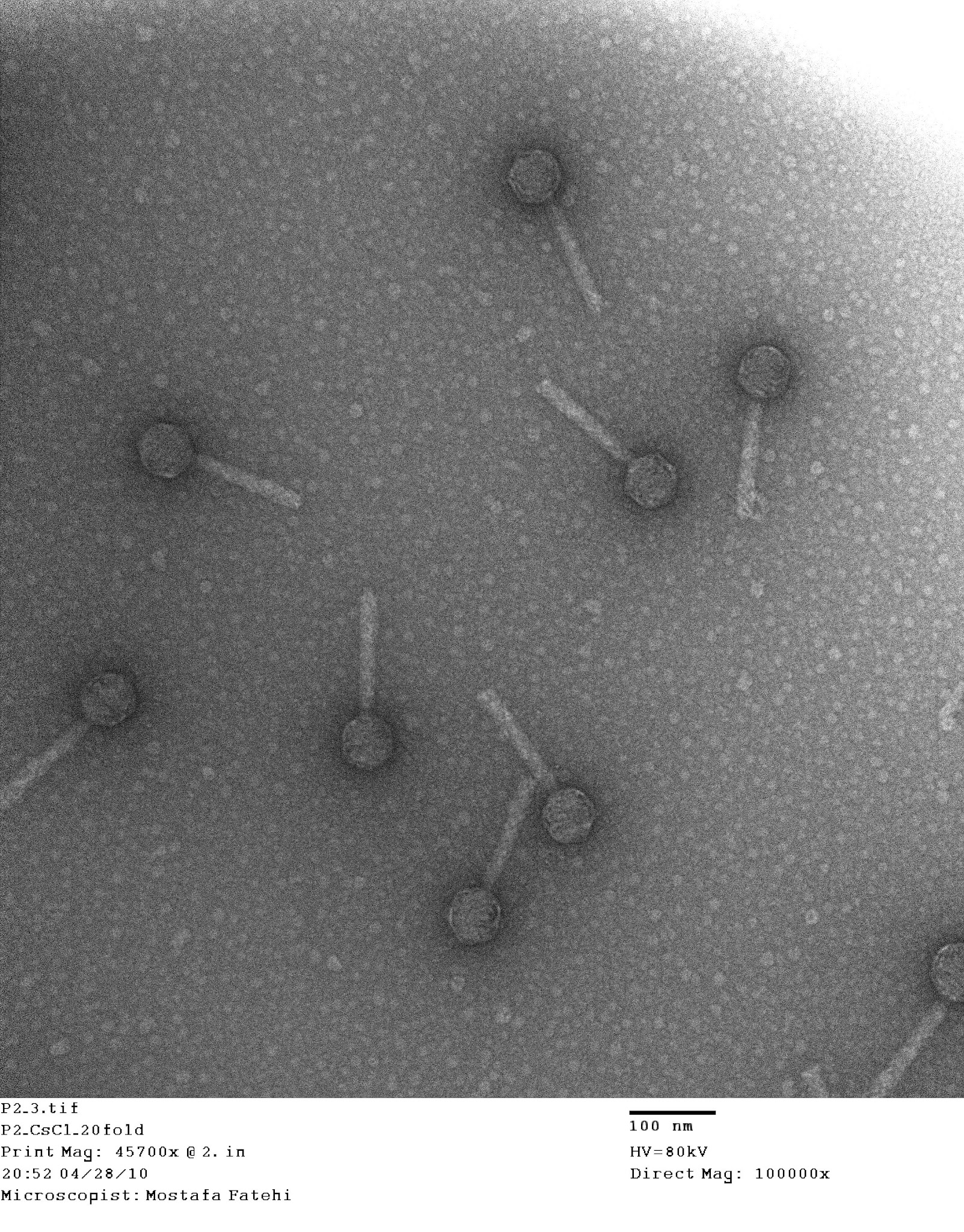 Electron micrograph showing several bacteriophage particles, with scale markings preserved.