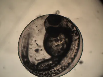 A developing zebrafish curled around its yolk inside a translucent egg.